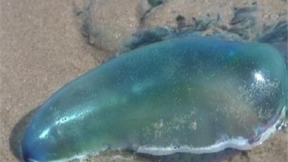 Beach Patrol 475 people stung by jellyfish on South Padre Island KGBT