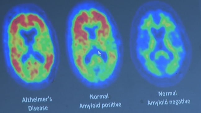 Health Check: Registry for Alzheimer's disease